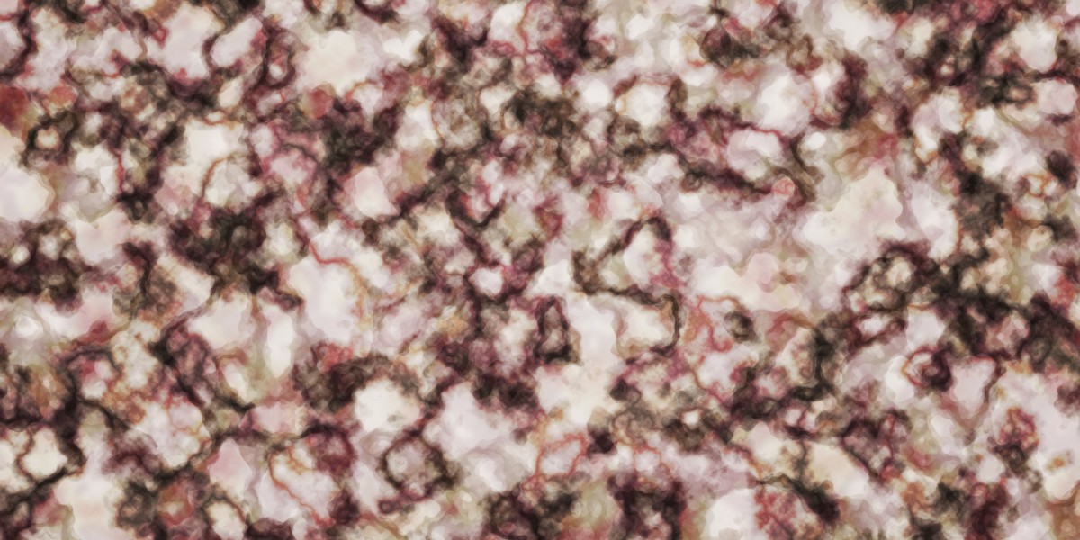 Erectile Dysfunction: Understanding Causes, Impacts, And Treatment Choices