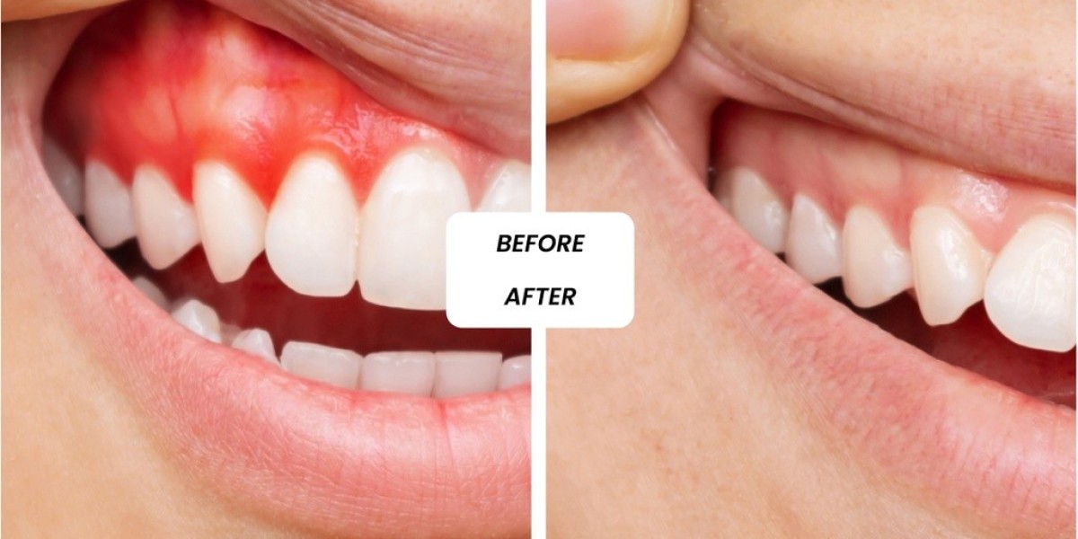 General Dentistry in Dubai: Comprehensive Oral Health Solutions