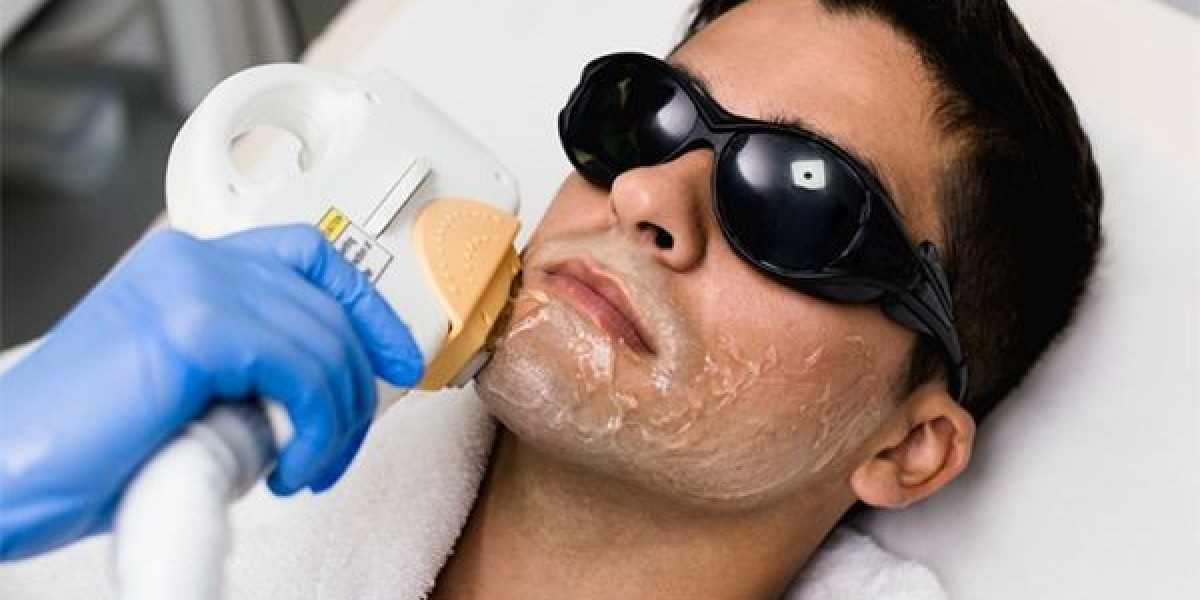 Laser Hair Removal in Islamabad: Stay Comfortable During High-Intensity Workouts