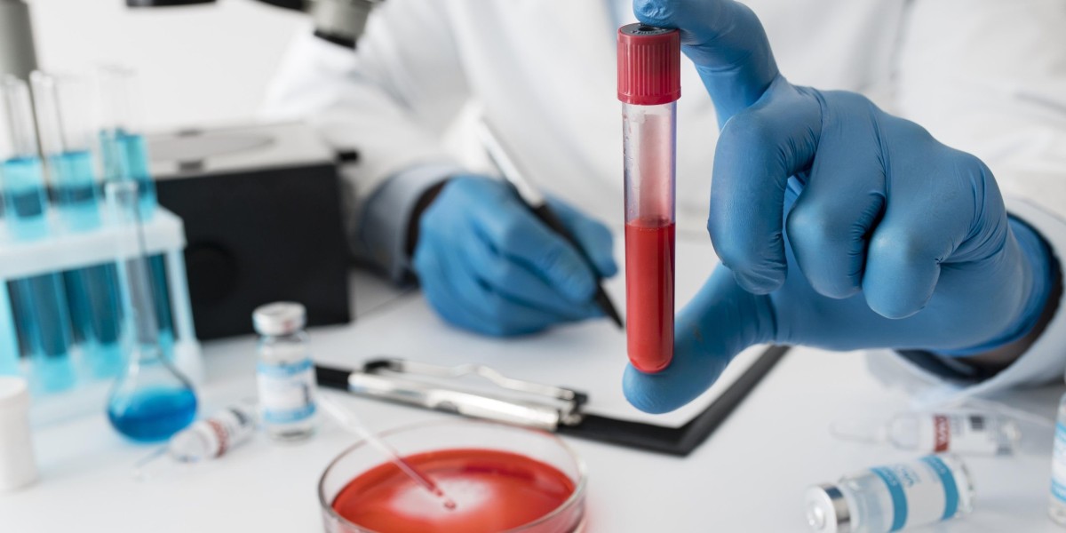 Blood Testing at Home in Bangalore: A Complete, Practical Guide by ecotown
