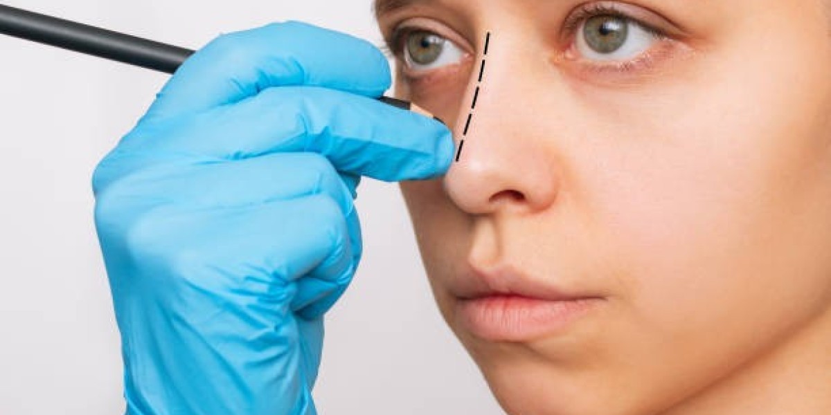 Rhinoplasty in Riyadh: The Definitive Patient Guide for 2026