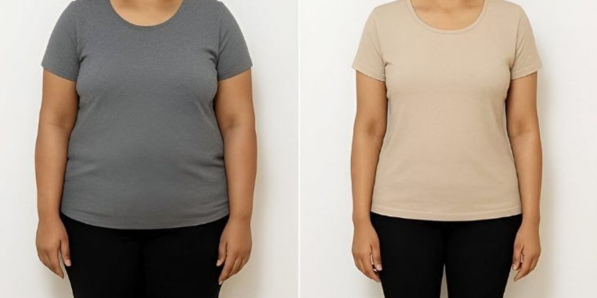 Mounjaro Injection in Islamabad: Expert Medical Weight Loss