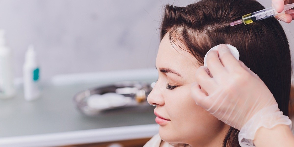 PRP Hair Treatment in Islamabad: Complete Guide