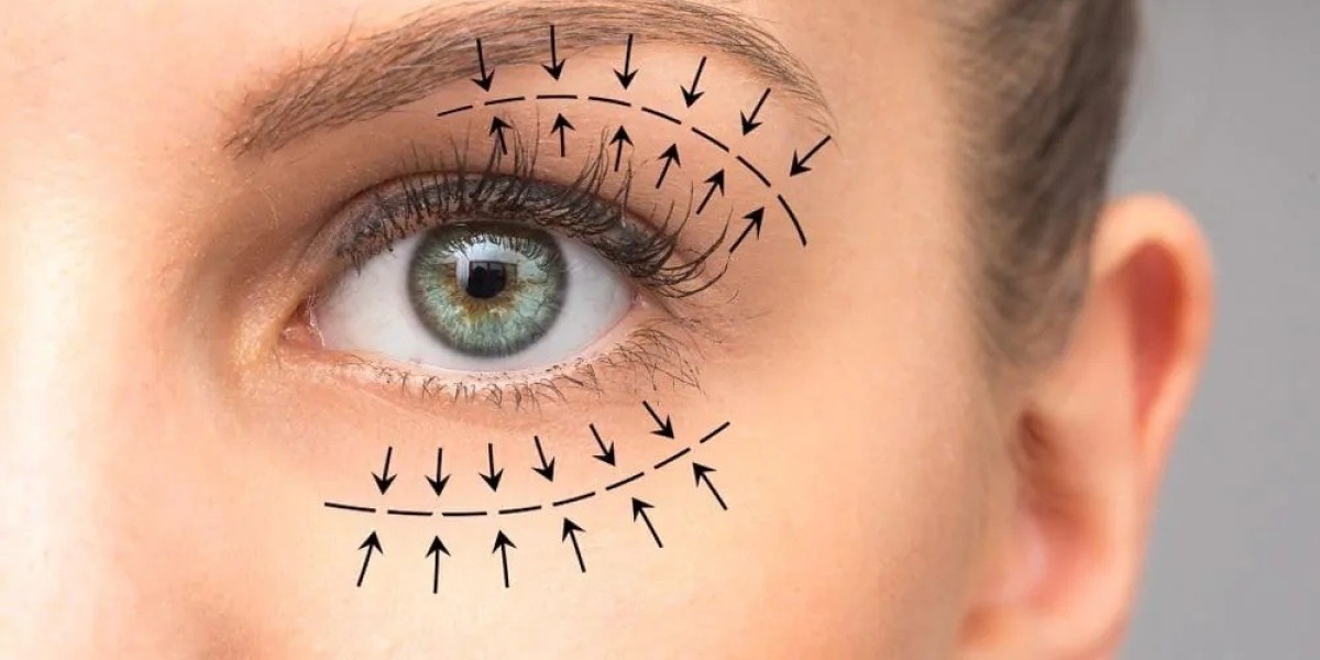 Eye Bag Removal in Islamabad: Which Treatment is Right for You?