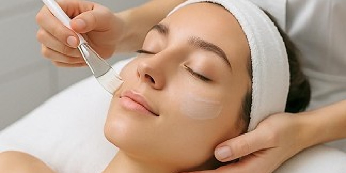 Understanding the Recovery Timeline for Chemical Peels in Dubai