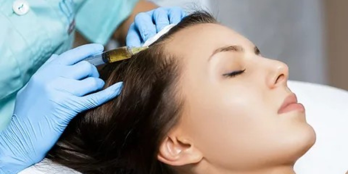 The Ultimate Blueprint: Strategy for PRP hair treatment in Dubai